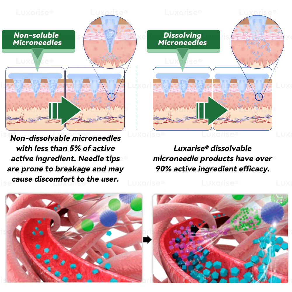 Official Store  | 👩‍⚕️Moringa & Berberine 10-IN-1 Advanced Nano Microneedle Patch (Once Daily, visible changes in 7 days)✅ Obesity, Diabetes, Sleep Apnea, And Joint Issues 🌹🌹