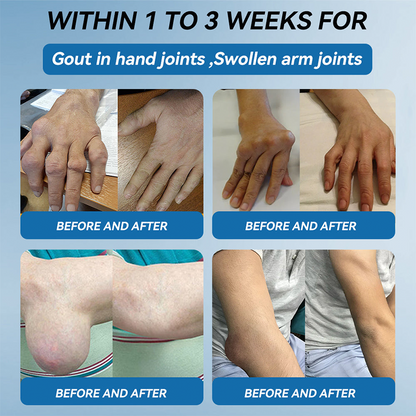 Official store 👩‍⚕️🥇| Cheemex® BPC-157 Joint Healing Cream🏃‍Treats Arthritis,Neuropathy,Rheumatism,Sports Injuries&More👍